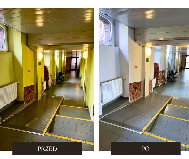 Szpital Miejski zmienia się dla gliwiczan – remont Zakładu Fizjoterapii zakończony